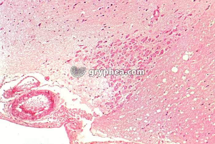 Hypothalamus x40 - gryphea.org